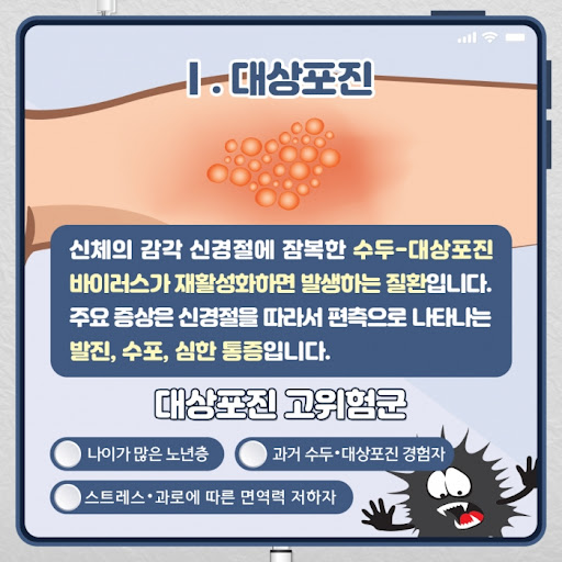 대상포진과 예방 접종의 중요성
